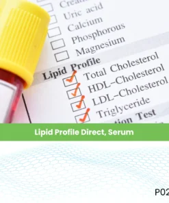 Lipid Profile Direct, Serum