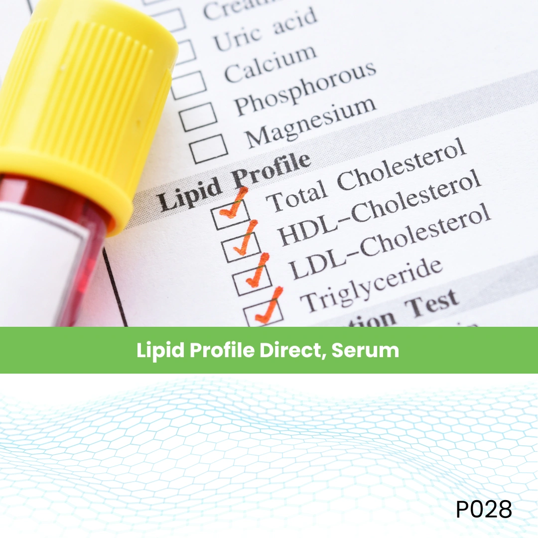 Lipid Profile Direct, Serum