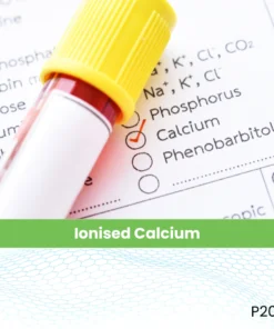 Ionised Calcium