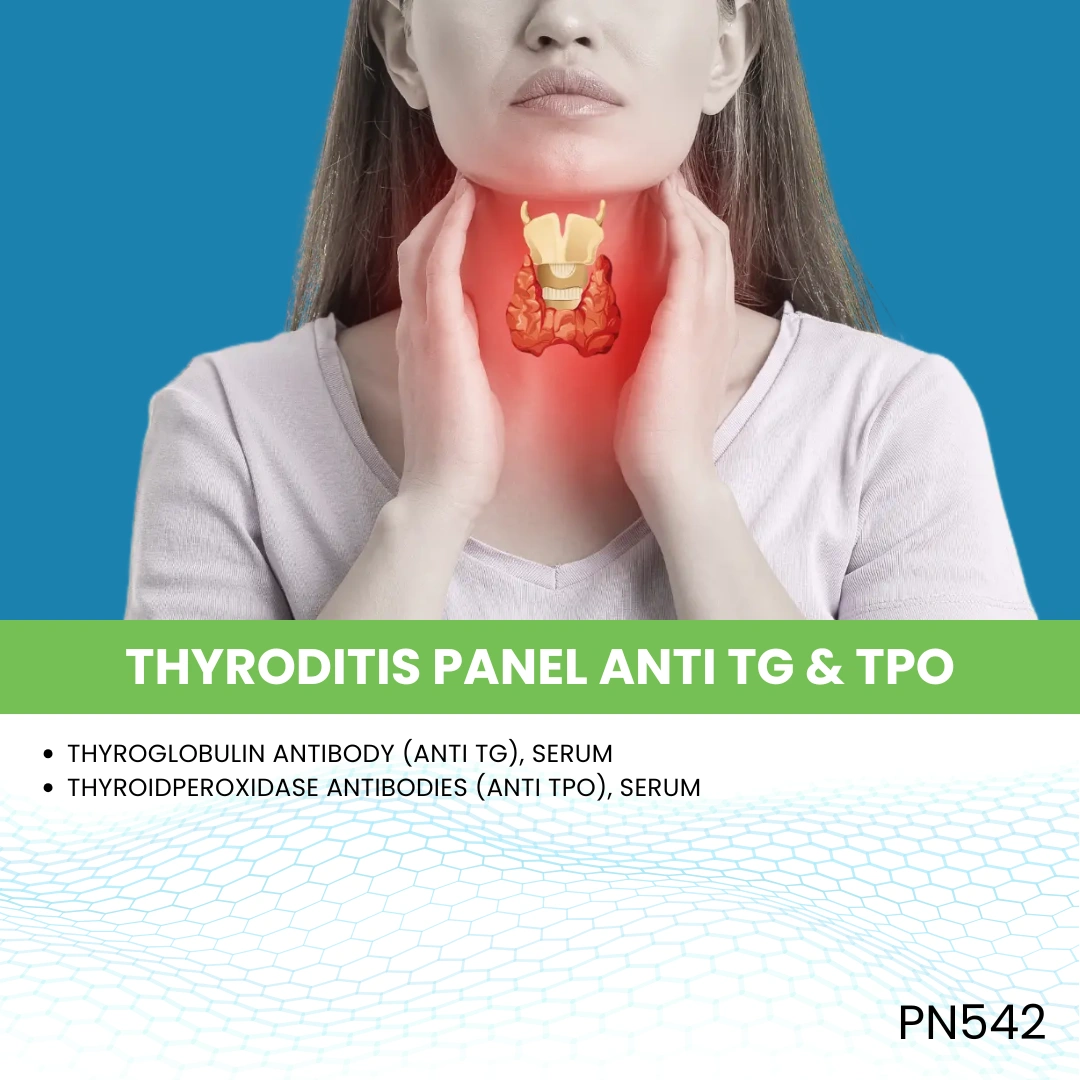 THYRODITIS PANEL ANTI TG & TPO