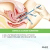 CERVICAL CANCER SCREENING
