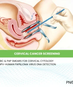 CERVICAL CANCER SCREENING