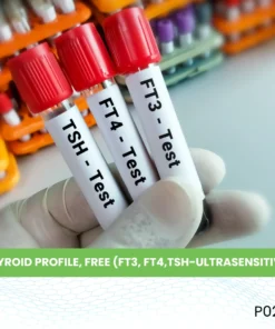 THYROID PROFILE, FREE (FT3, FT4,TSH-ULTRASENSITIVE)