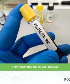 THYROID PROFILE,TOTAL, SERUM