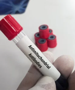 ANTI MITOCHONDRIAL ANTIBODIES (AMA)