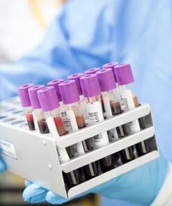 Jak2 V617F Mutation Detection