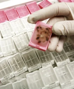 Histopathology, Large Specimen*