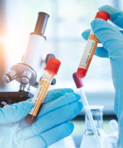 Adenosine Deaminase, Serum