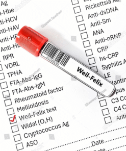 WEIL- FELIX TEST, SERUM