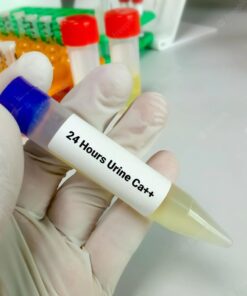 Adrenaline (Epinephrine) Urine 24H