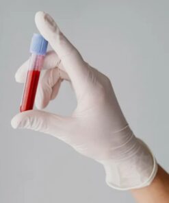 Alanine Aminotransferase (Alt/ Sgpt), Serum