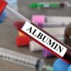 Albumin, Serum