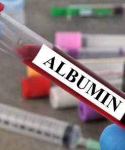 Albumin, Serum