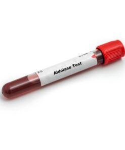 Aldolase, Serum