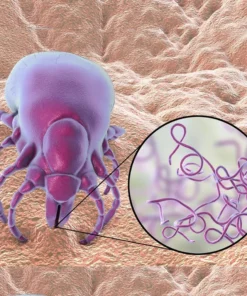 Lyme Disease (Borrelia Burgdorferi) Antibodies,Igm