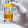 Magnesium, Random Urine