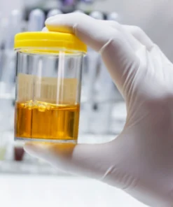 Magnesium, Random Urine