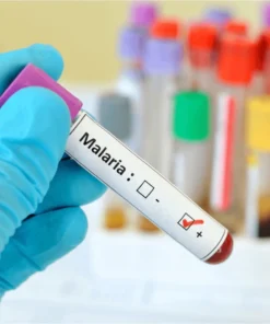Malaria Antigen, Whole Blood