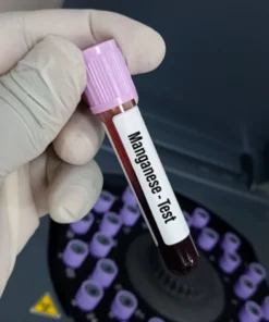 Manganese Blood