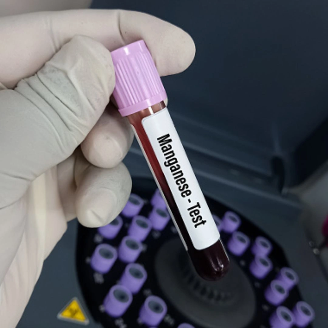 Manganese Blood