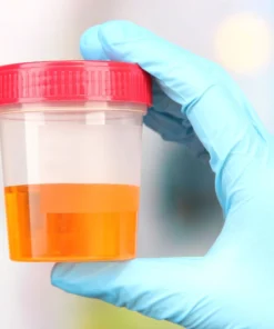 Manganese Spot Urine