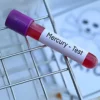 Mercury,Serum