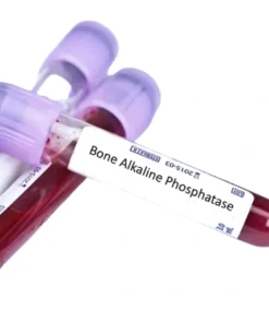 ALKALINE PHOSPHATASE, BONE-SPECIFIC (BSAP), SERUM