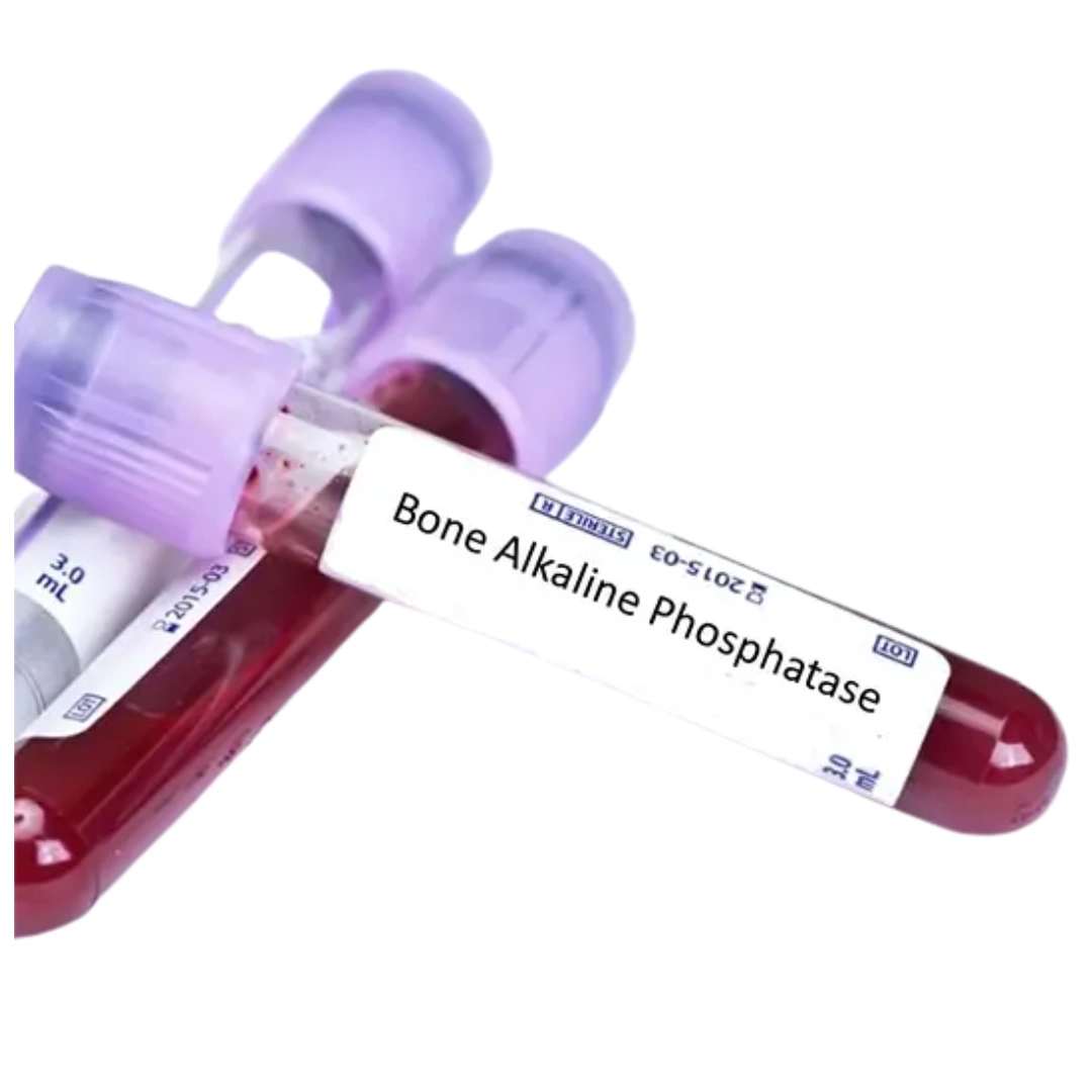 ALKALINE PHOSPHATASE, BONE-SPECIFIC (BSAP), SERUM