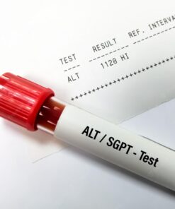 ALANINE AMINOTRANSFERASE (ALT/ SGPT), SERUM
