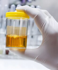 17-Ketosteroids, Urine 24H