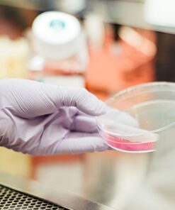 5-Hydroxy Indole Acetic Acid (Hiaa), Urine 24H