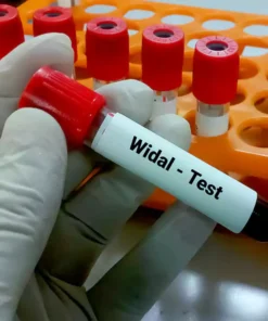 WIDAL TEST,  SERUM