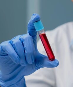 Absolute Eosinophil Count(Aec), Whole Blood