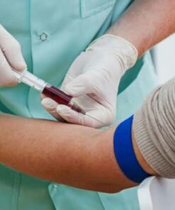 Acetylcholine Receptor Binding Antibody, Serum