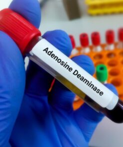 Adenosine Deaminase, Fluid