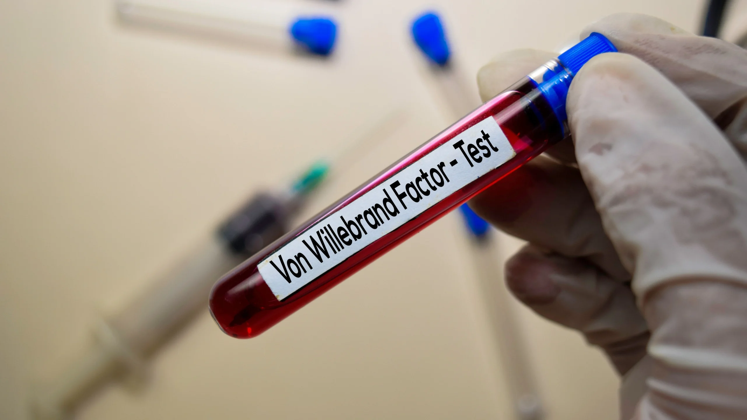 VON WILLEBRAND FACTOR ANTIGEN, PLASMA