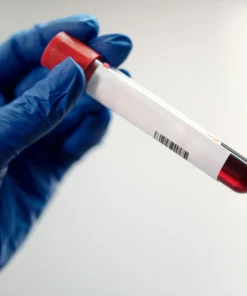 Mumps Igg Antibodies