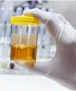 Nickel, 24 Hrs Urine