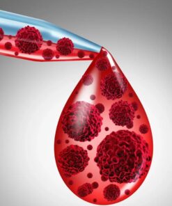 Microfilaria Antigen Detection, Whole Blood