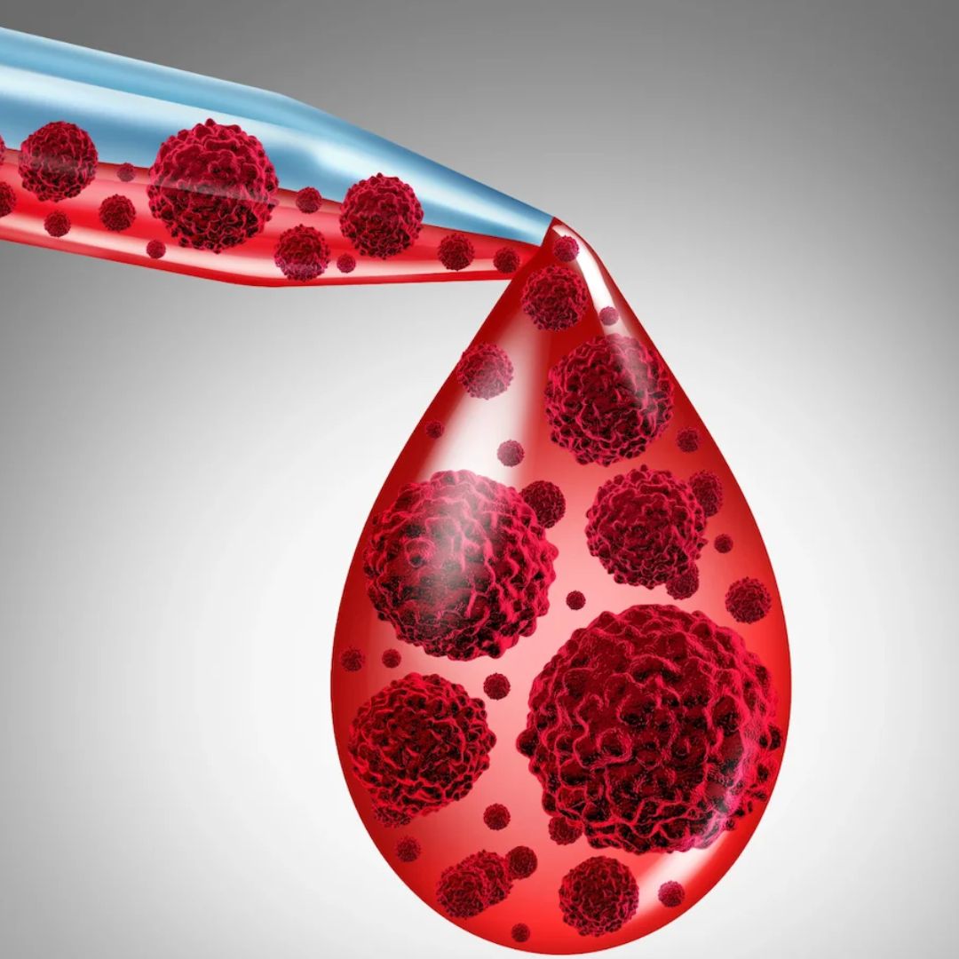 Microfilaria Antigen Detection, Whole Blood