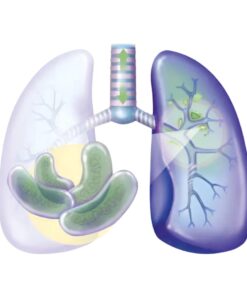 Mtb Detection Test By Real Time Pcr
