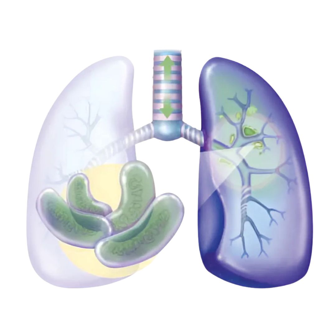 Mtb Detection Test By Real Time Pcr