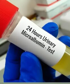 Microalbumin, 24 Hrs Urine