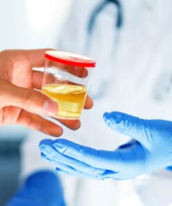 Microalbumin, Random Urine