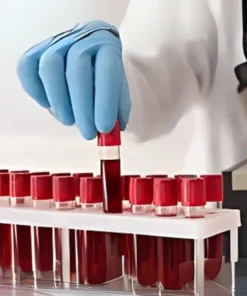 Musk Antibody Muscle Specific Kinase Ab