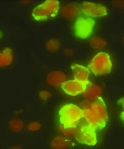 Mycoplasma Pneumoniae Igm Antibodies