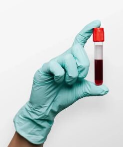 Microfilaria Antibody