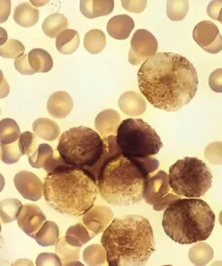 Myeloperoxidase (Mpo) Stain