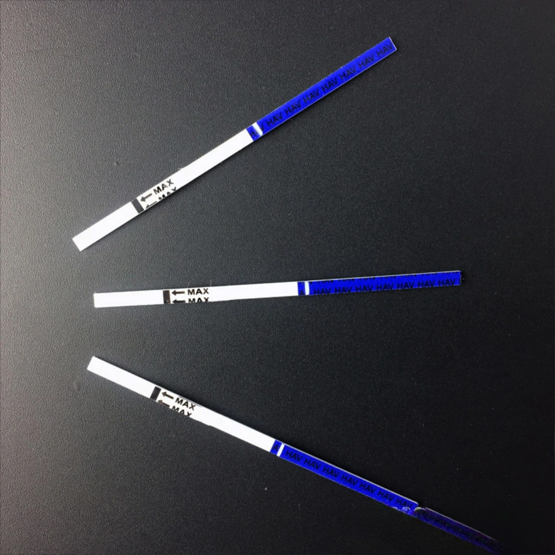 HAV IGM (HEPATITIS A VIRUS, IGM), SERUM