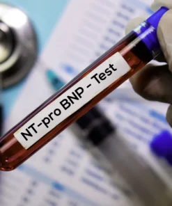 N-Terminal Pro B Natriuretic Peptide